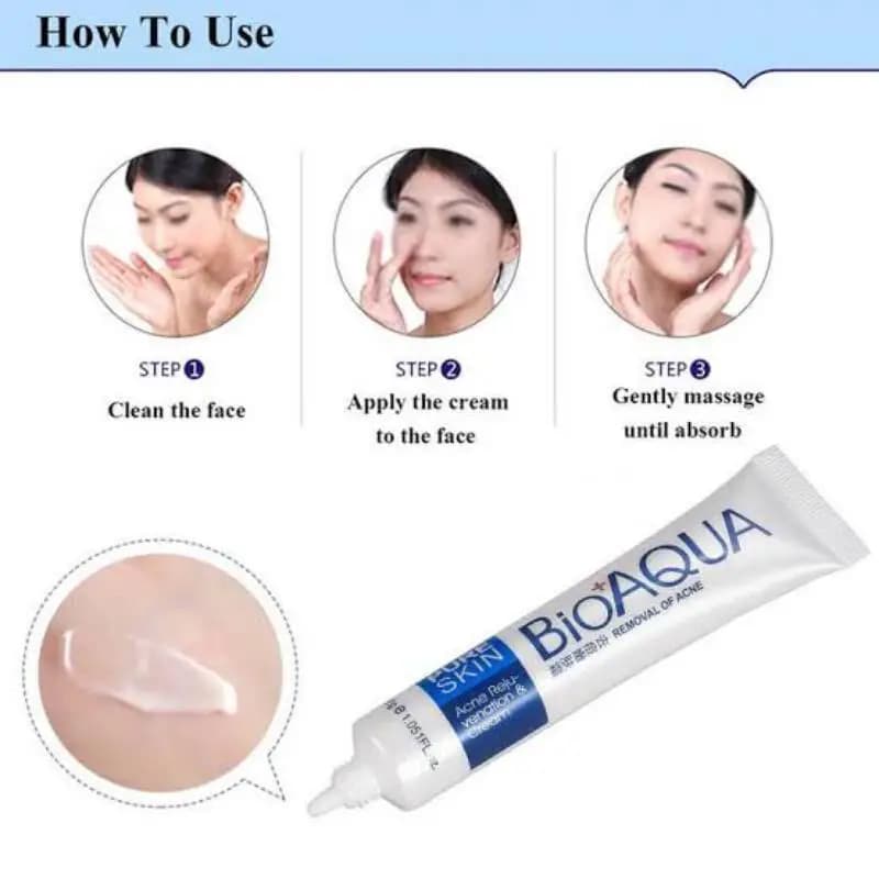 Acne Removal Face Cream